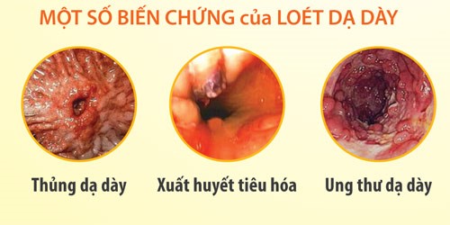 Nước ion kiềm – nước tốt 